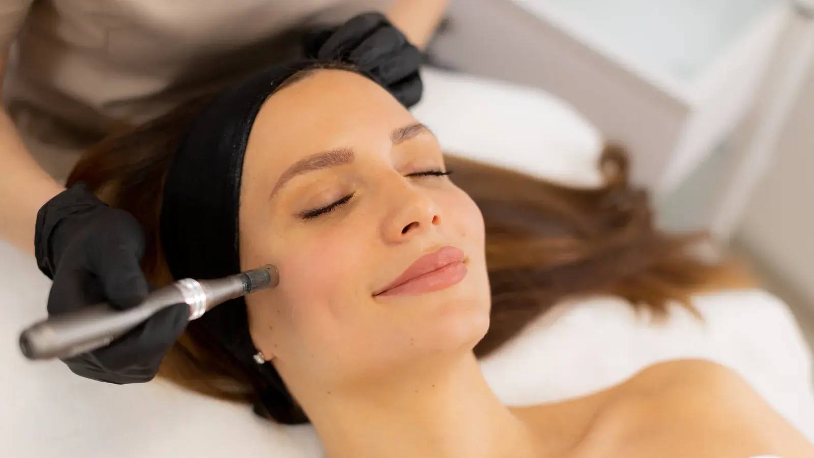 Microneedling Treatment