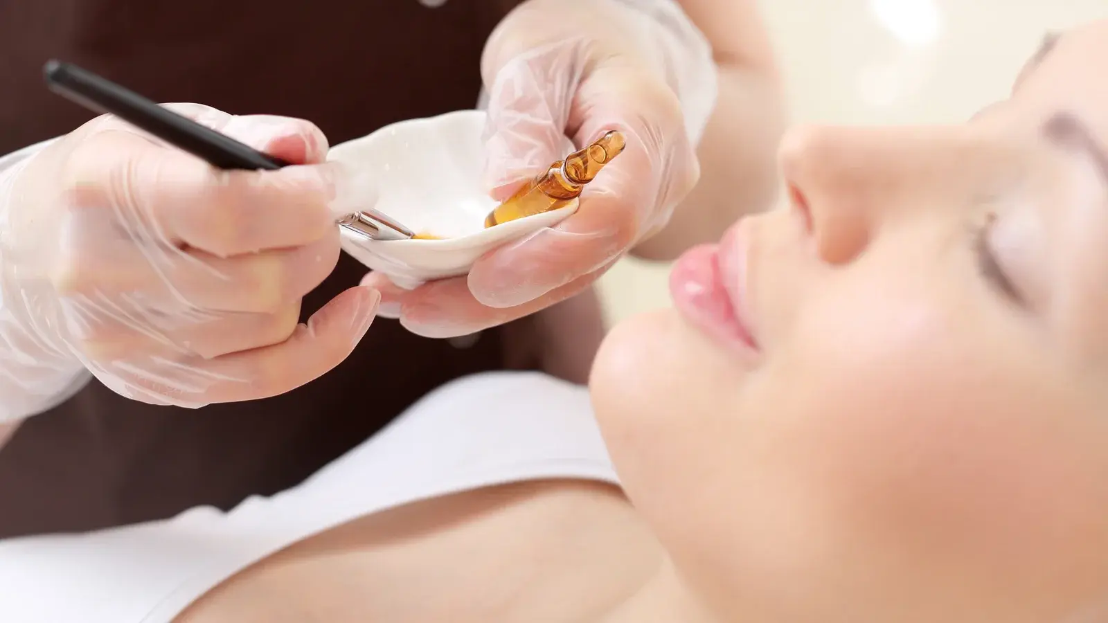 Chemical Peel Treatment