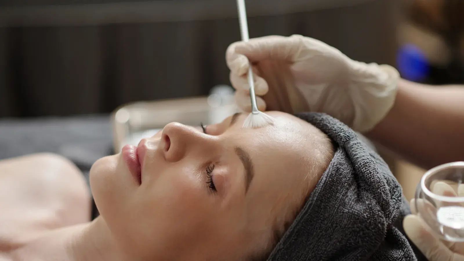 Chemical Peel Treatment