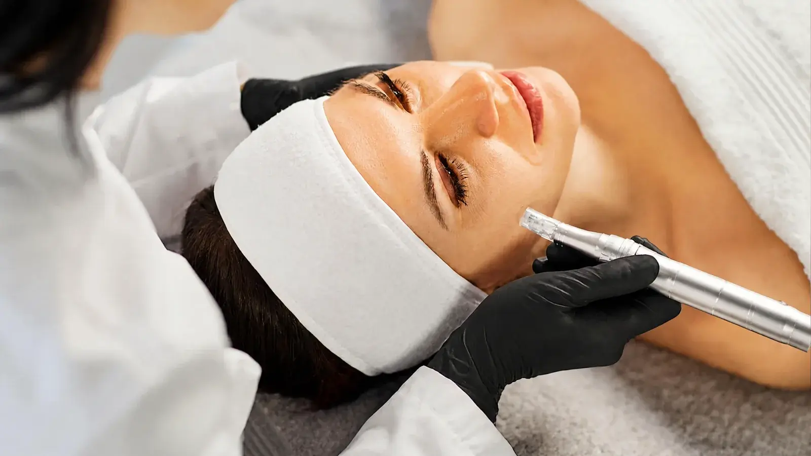 Microneedling Treatment